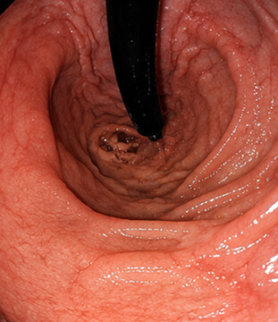 Endoscopia Digestiva